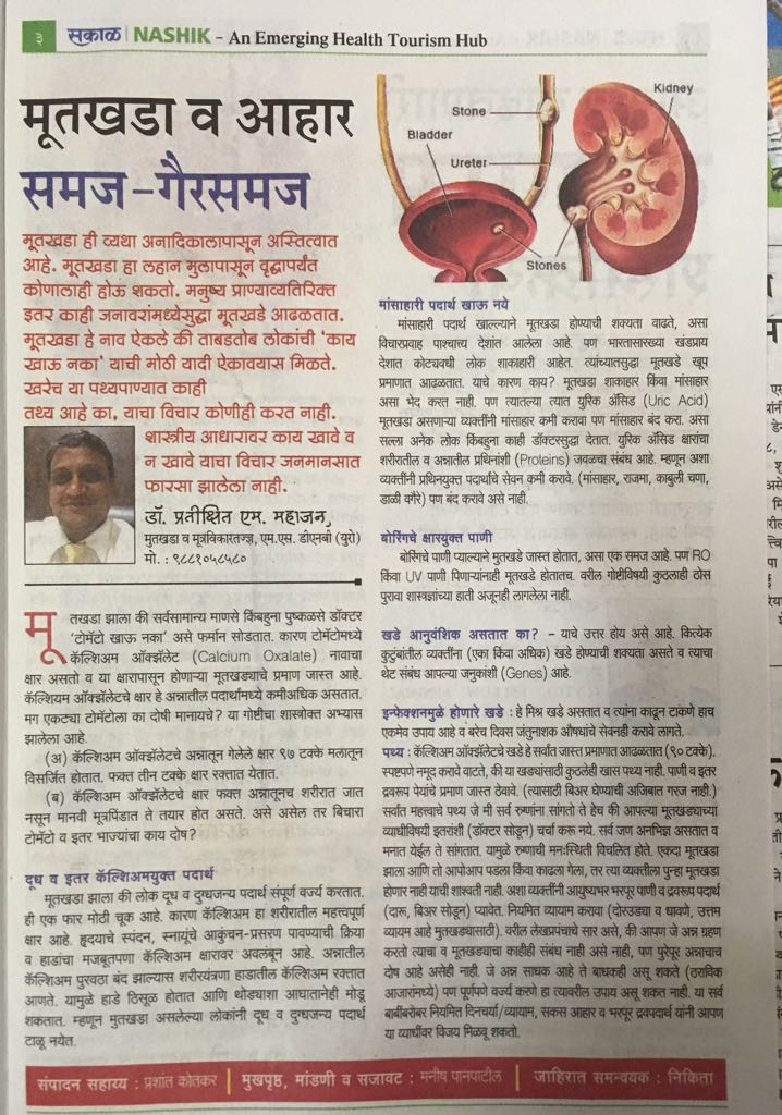 Prostate Surgery